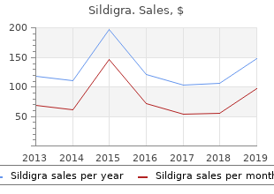 cheap 25 mg sildigra with visa